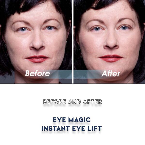 Before and After Eye Magic Original