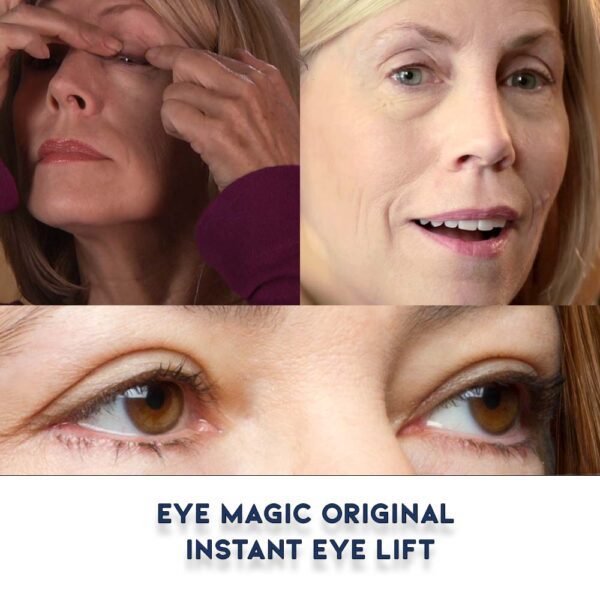 Before and After Eye Magic Original Eye Lift