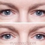 before and after eye magic 4