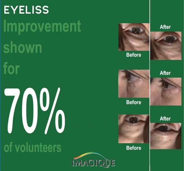 Eyeliss-70-percent-improvement