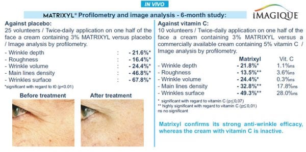 image Matrixl-profilometry-and-image-analysis-6-mo-study