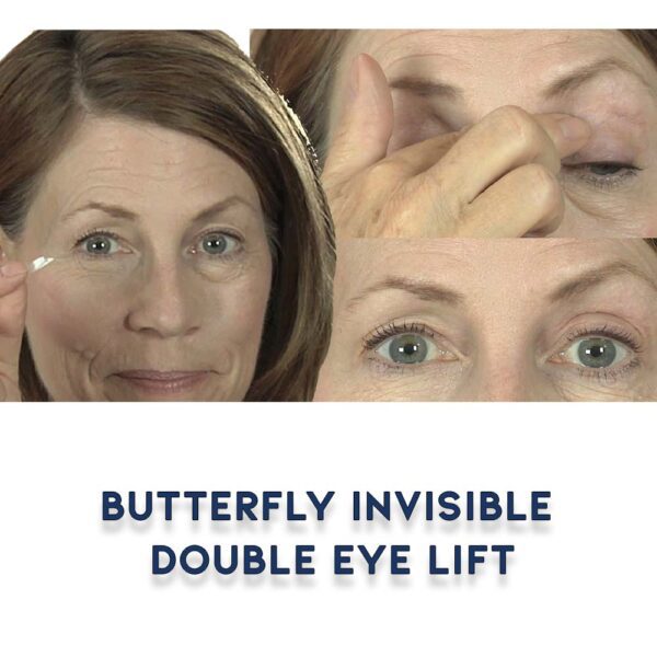 Before and After Butterfly Invisible Double Eye Lift