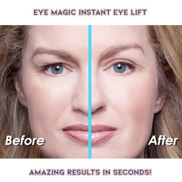 Before and After Eye Magic