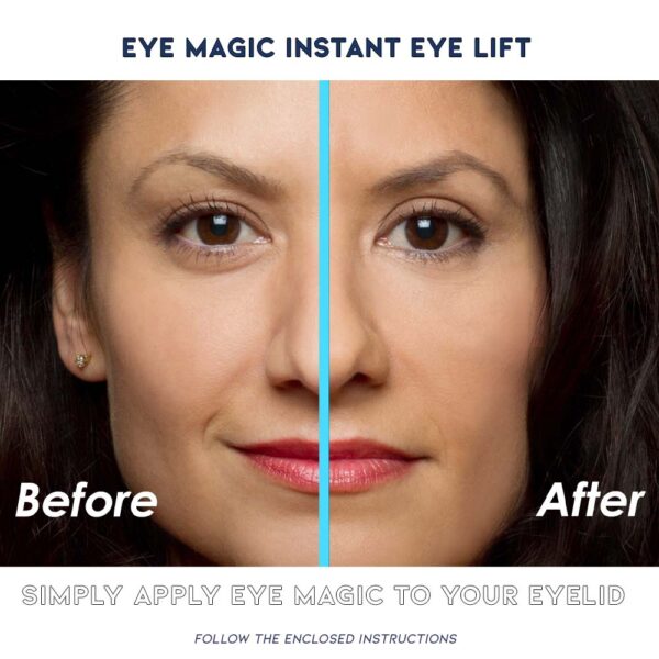 Before and After Eye Magic